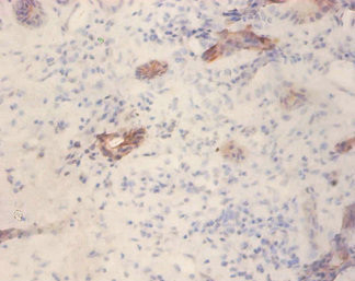 GLP1R Antibody in Immunohistochemistry (Paraffin) (IHC (P))