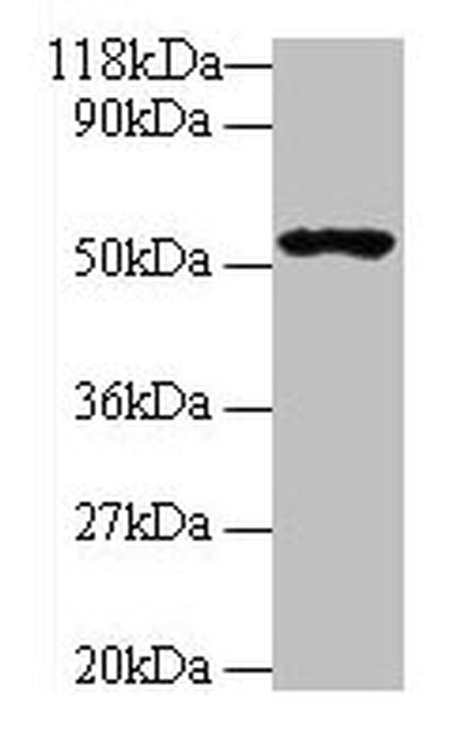 GLP1R Antibody in Western Blot (WB)