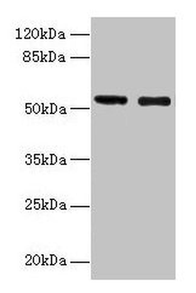 GLP1R Antibody in Western Blot (WB)