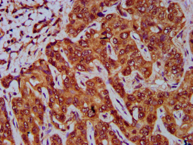 GNA12 Antibody in Immunohistochemistry (Paraffin) (IHC (P))