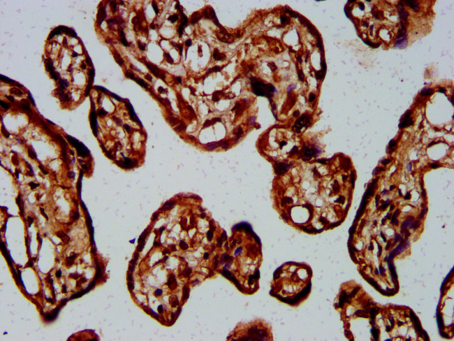 GNA12 Antibody in Immunohistochemistry (Paraffin) (IHC (P))