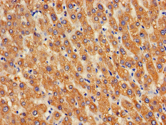 GOSR2 Antibody in Immunohistochemistry (Paraffin) (IHC (P))