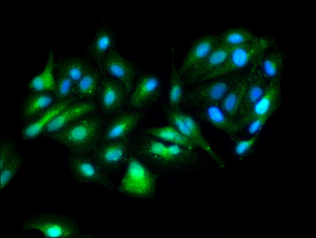 GOT1 Antibody in Immunocytochemistry (ICC/IF)