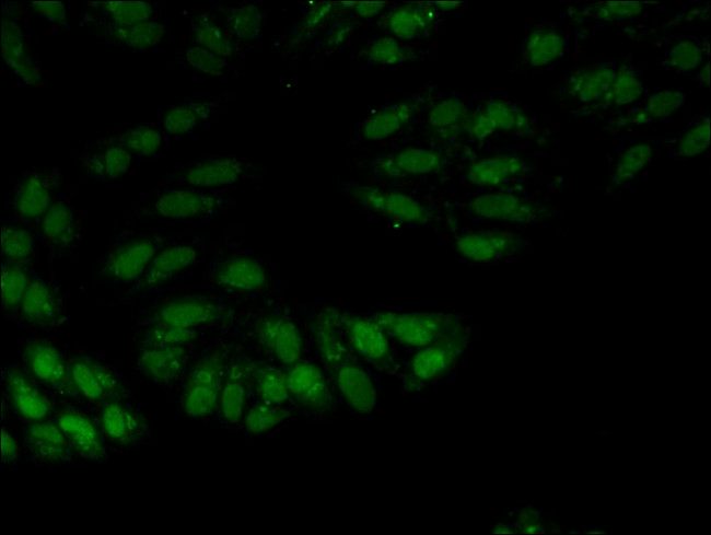 SNRPA Antibody in Immunocytochemistry (ICC/IF)