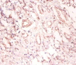 SNRPA Antibody in Immunohistochemistry (Paraffin) (IHC (P))