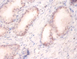 SNRPA Antibody in Immunohistochemistry (Paraffin) (IHC (P))