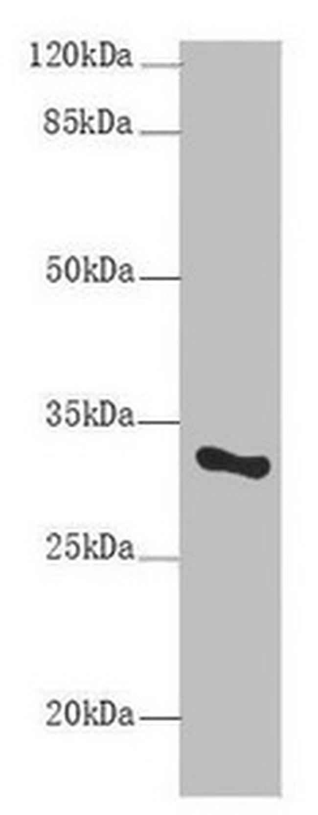 SNRPA Antibody in Western Blot (WB)