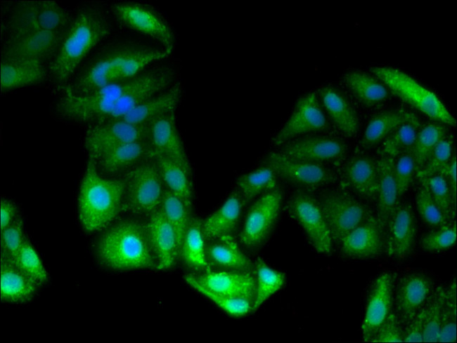 GPT Antibody in Immunocytochemistry (ICC/IF)