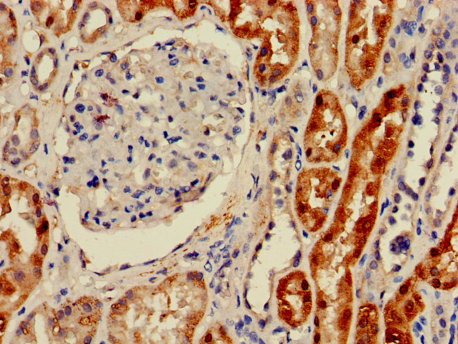 GPT Antibody in Immunohistochemistry (Paraffin) (IHC (P))