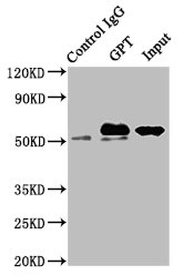 GPT Antibody in Western Blot (WB)