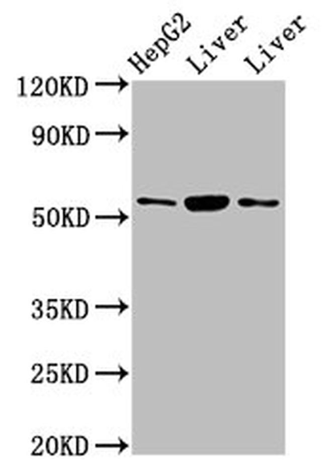 GPT Antibody in Western Blot (WB)