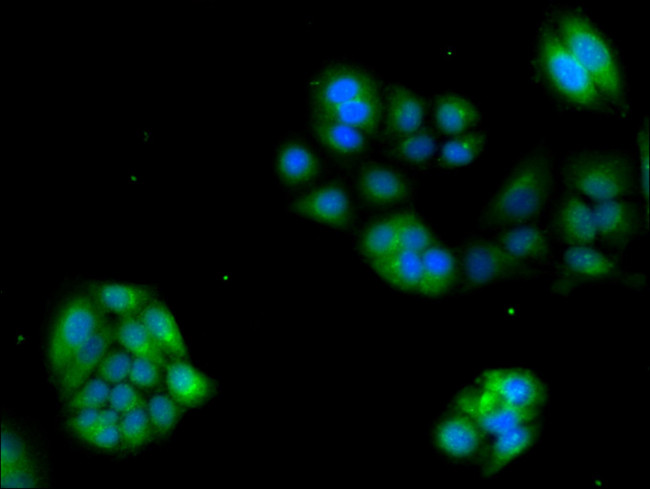 GRK4 Antibody in Immunocytochemistry (ICC/IF)