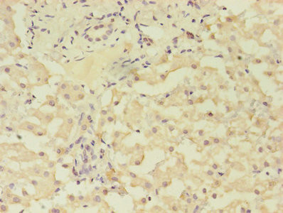 GRK4 Antibody in Immunohistochemistry (Paraffin) (IHC (P))