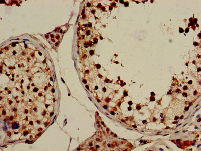 GRK4 Antibody in Immunohistochemistry (Paraffin) (IHC (P))