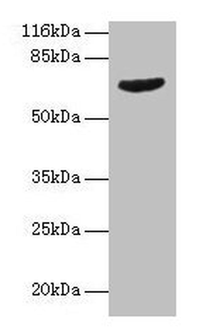 GRK4 Antibody in Western Blot (WB)