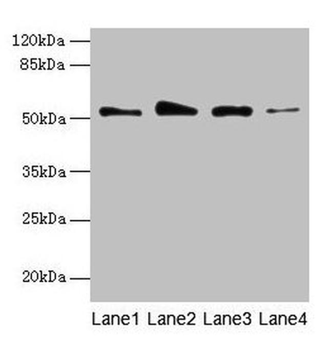 GSDMD Antibody in Western Blot (WB)