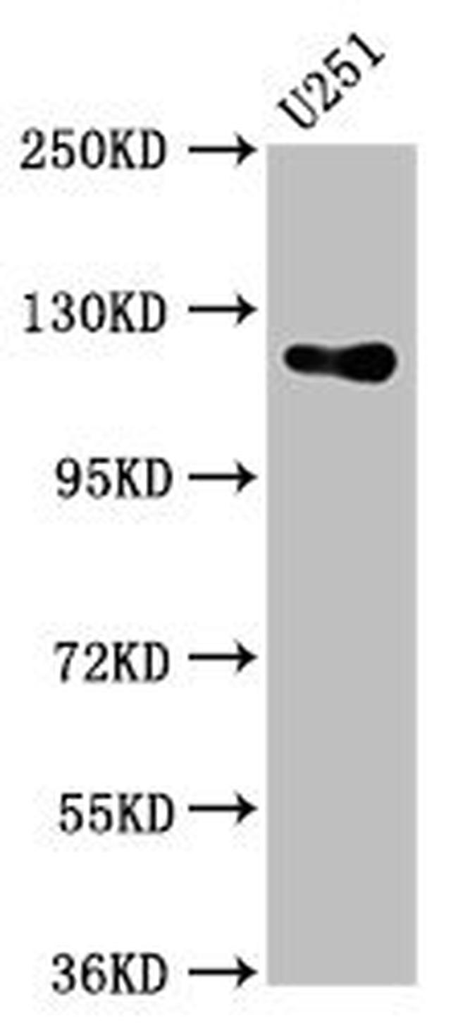 PGCD Antibody in Western Blot (WB)