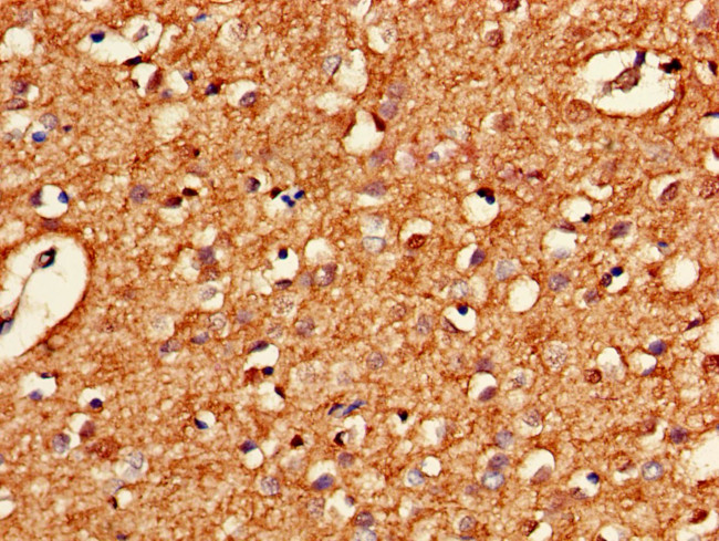 HARS2 Antibody in Immunohistochemistry (Paraffin) (IHC (P))