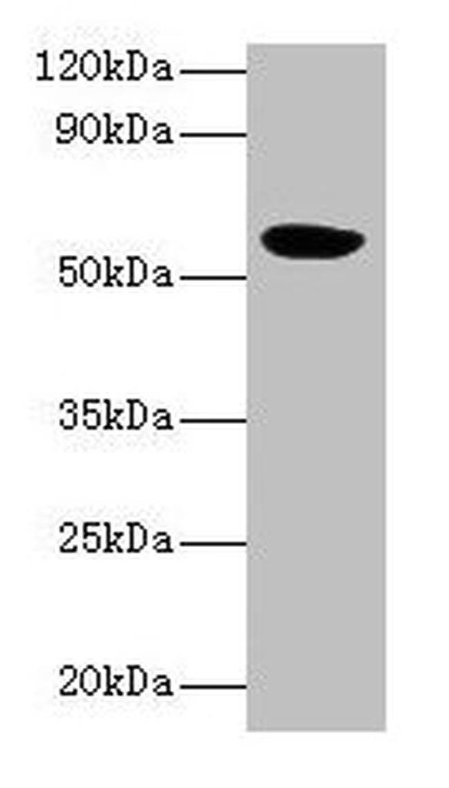 HARS2 Antibody in Western Blot (WB)