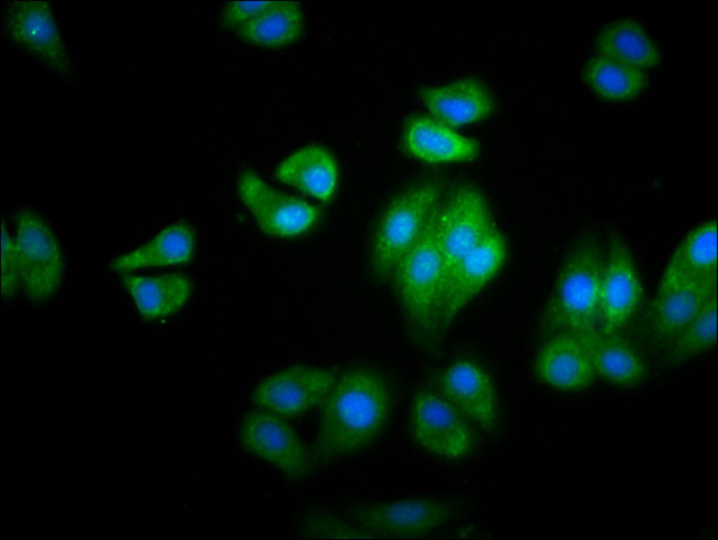 HBG2 Antibody in Immunocytochemistry (ICC/IF)