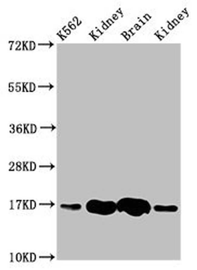 HBG2 Antibody in Western Blot (WB)