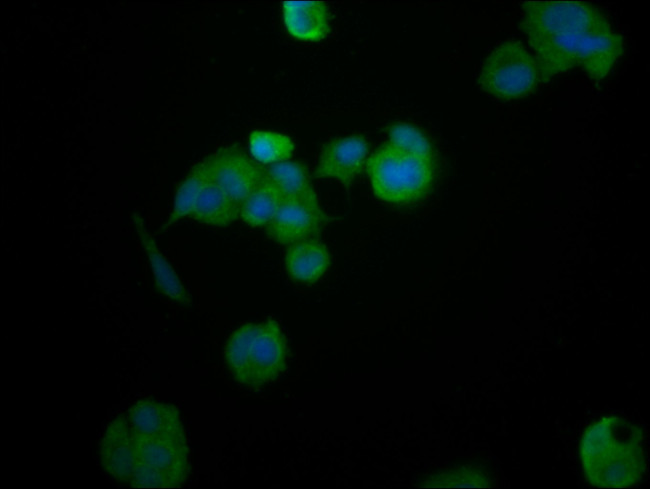 HEPACAM Antibody in Immunocytochemistry (ICC/IF)