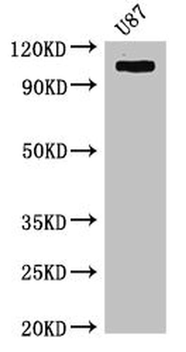 HK2 Antibody in Western Blot (WB)