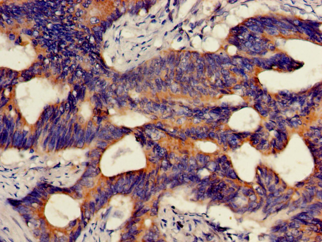 HMBS Antibody in Immunohistochemistry (Paraffin) (IHC (P))