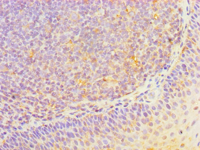 HOXA1 Antibody in Immunohistochemistry (Paraffin) (IHC (P))