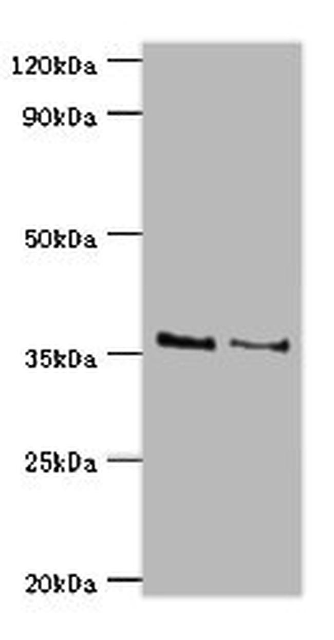 HOXA1 Antibody in Western Blot (WB)