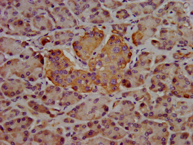 Hepsin Antibody in Immunohistochemistry (Paraffin) (IHC (P))