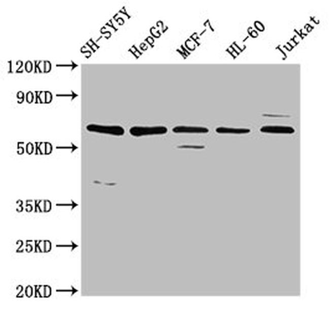 HRG Antibody in Western Blot (WB)