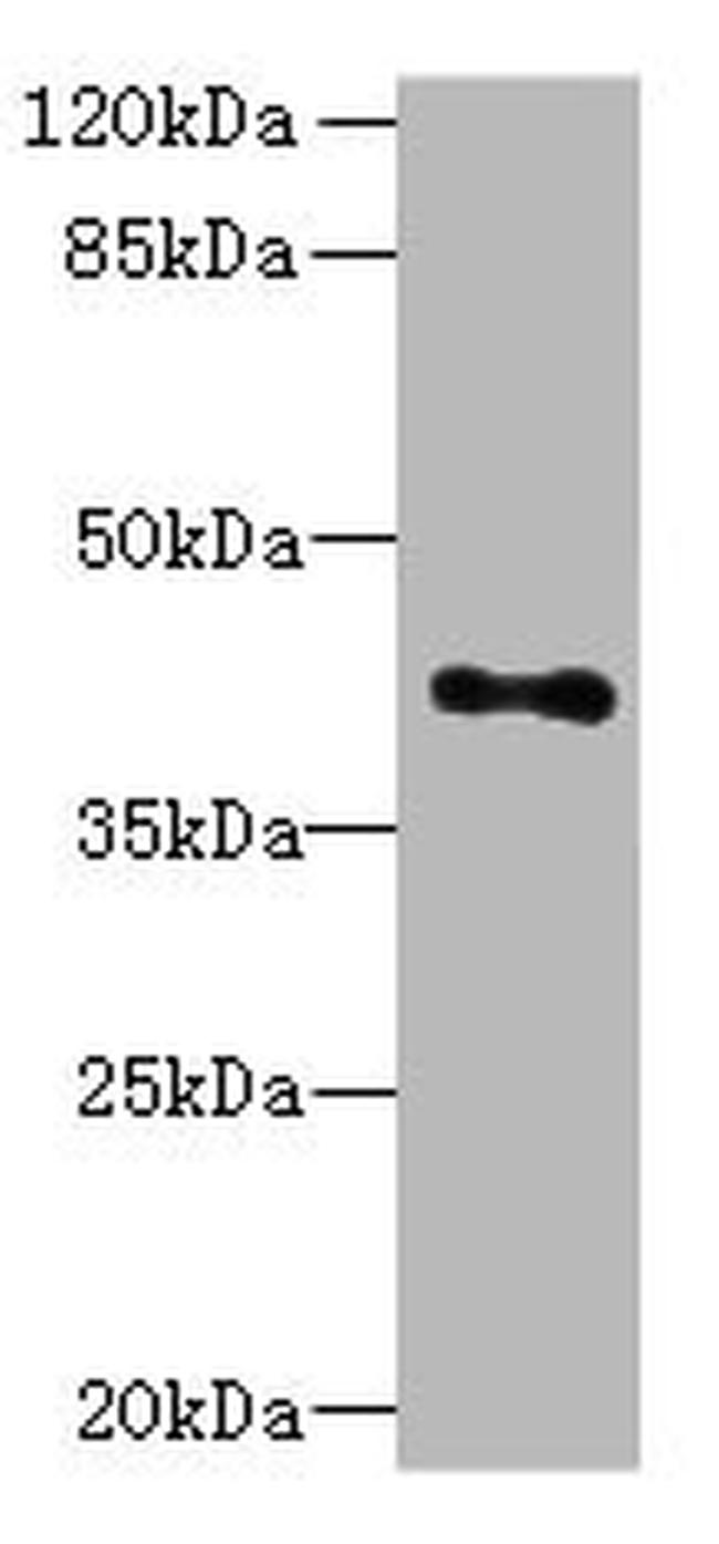 HTR1E Antibody in Western Blot (WB)