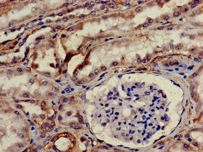 HTRA2 Antibody in Immunohistochemistry (Paraffin) (IHC (P))