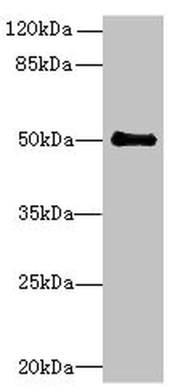 IFI44 Antibody in Western Blot (WB)