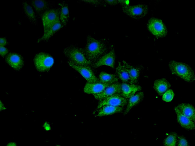 IFI44L Antibody in Immunocytochemistry (ICC/IF)