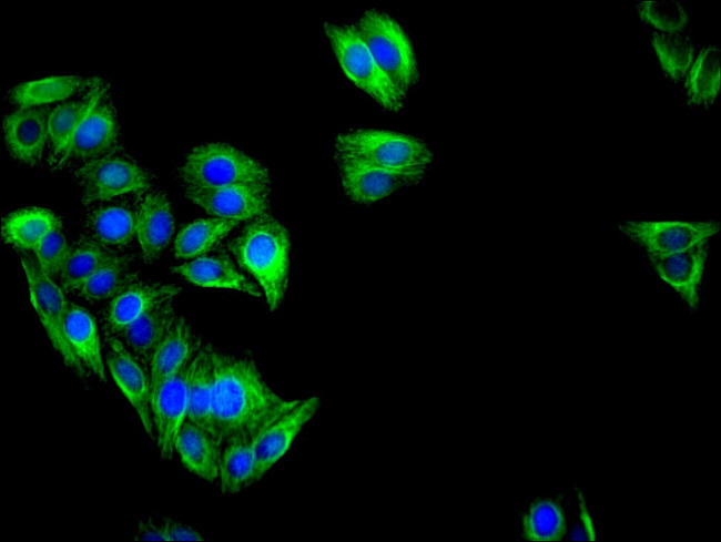 IFIT3 Antibody in Immunocytochemistry (ICC/IF)