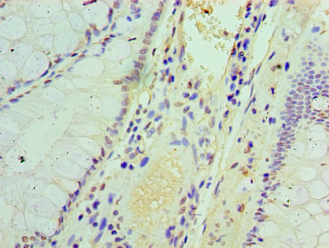 IFIT3 Antibody in Immunohistochemistry (Paraffin) (IHC (P))