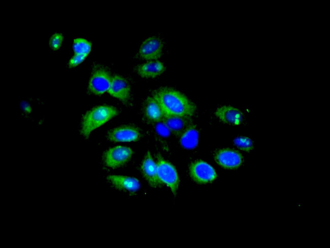 IFIT5 Antibody in Immunocytochemistry (ICC/IF)