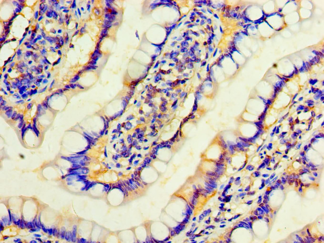 Interferon alpha-4 Antibody in Immunohistochemistry (Paraffin) (IHC (P))