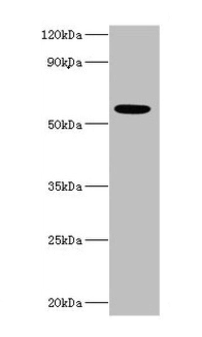 IFNAR2 Antibody in Western Blot (WB)