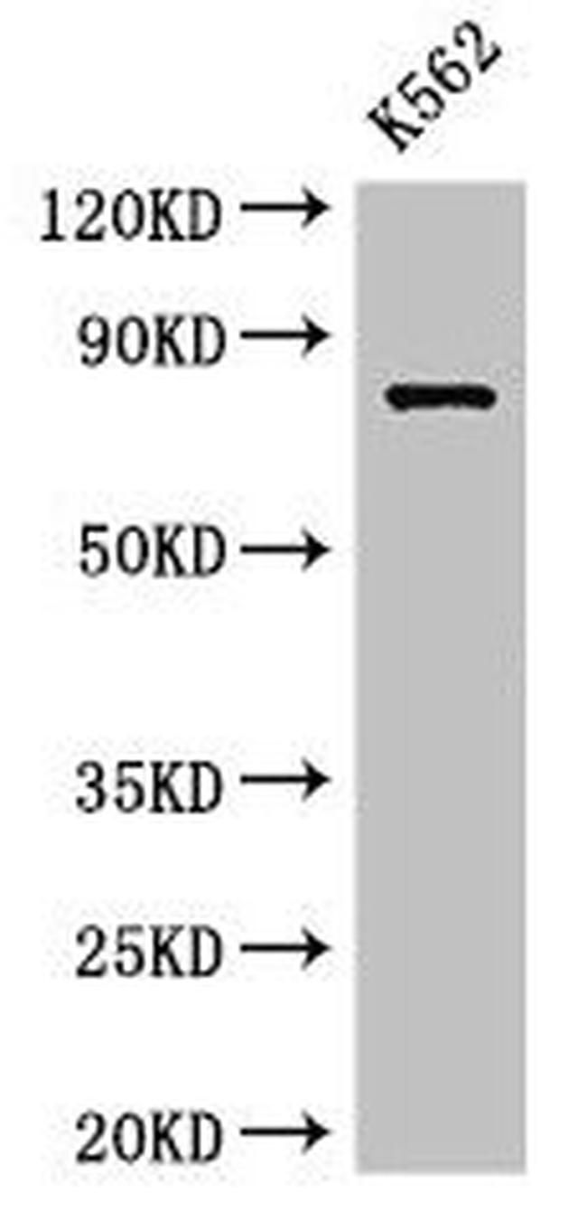 IL12RB1 Antibody in Western Blot (WB)