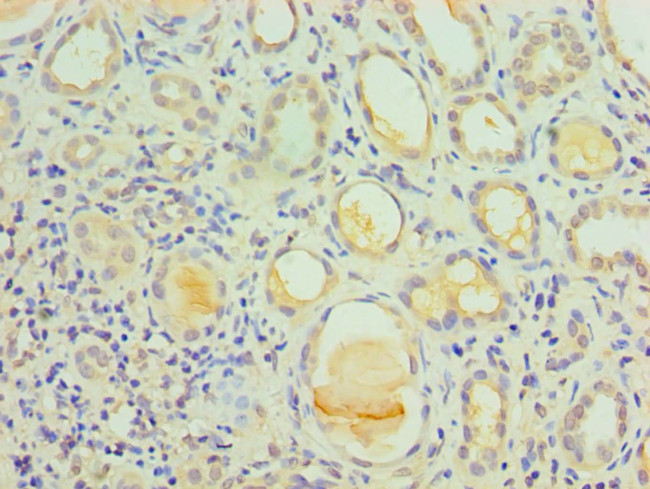 IL1R1 Antibody in Immunohistochemistry (Paraffin) (IHC (P))