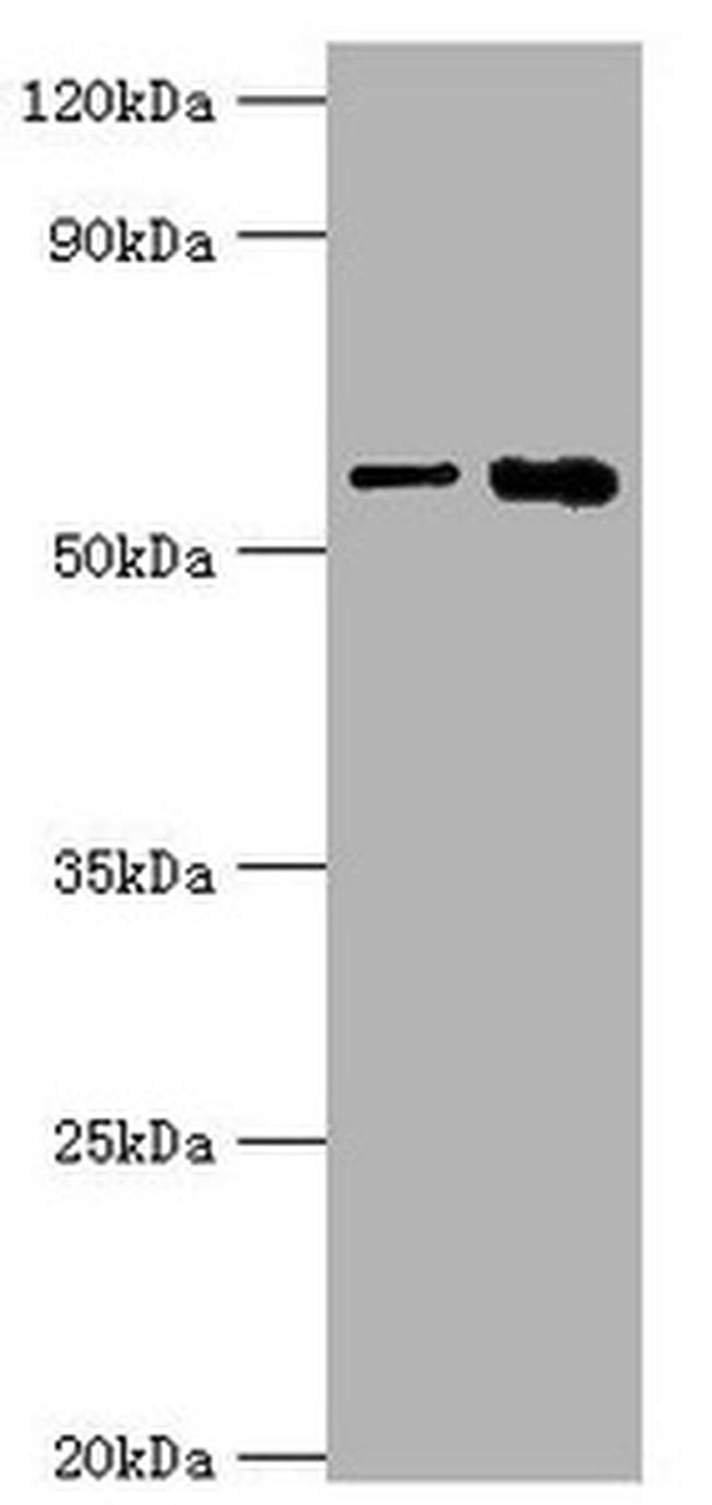 IL1R1 Antibody in Western Blot (WB)