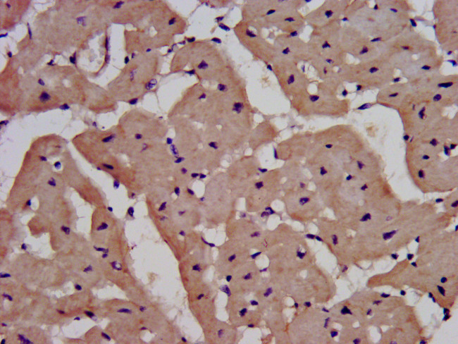 IL1RAPL1 Antibody in Immunohistochemistry (Paraffin) (IHC (P))