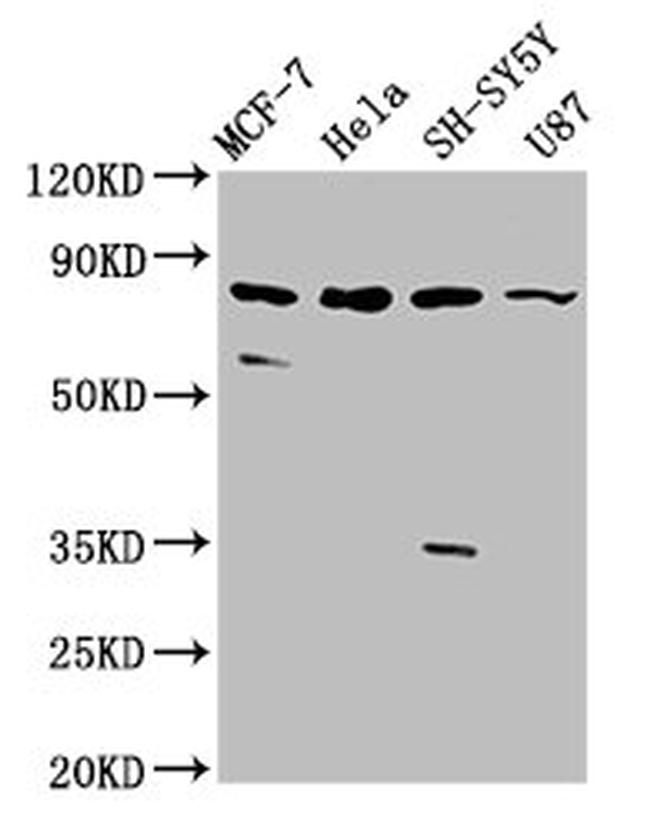 IL1RAPL1 Antibody in Western Blot (WB)