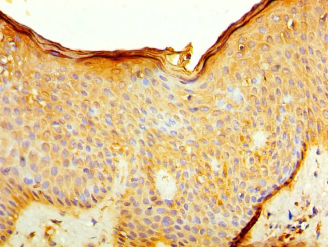 CD127 Antibody in Immunohistochemistry (Paraffin) (IHC (P))