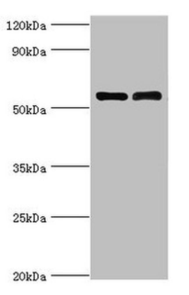 CD127 Antibody in Western Blot (WB)