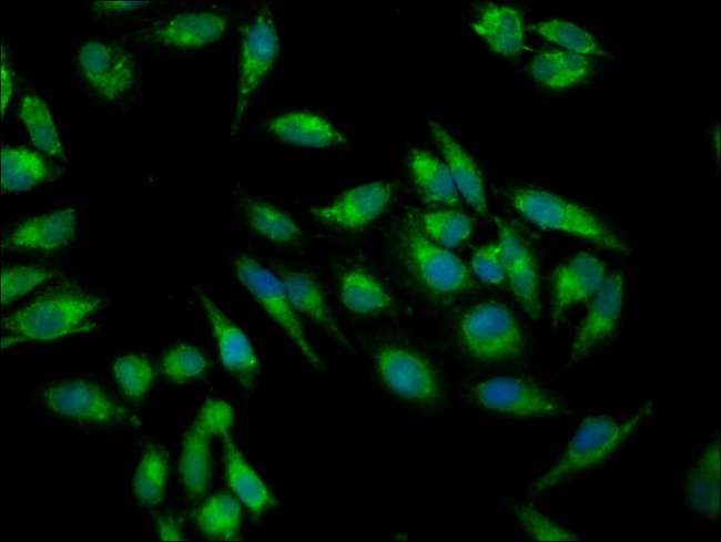 IMPDH2 Antibody in Immunocytochemistry (ICC/IF)