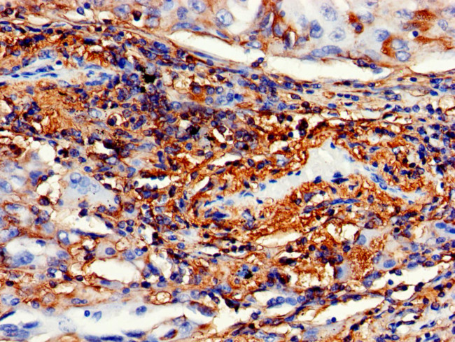 IMPDH2 Antibody in Immunohistochemistry (Paraffin) (IHC (P))